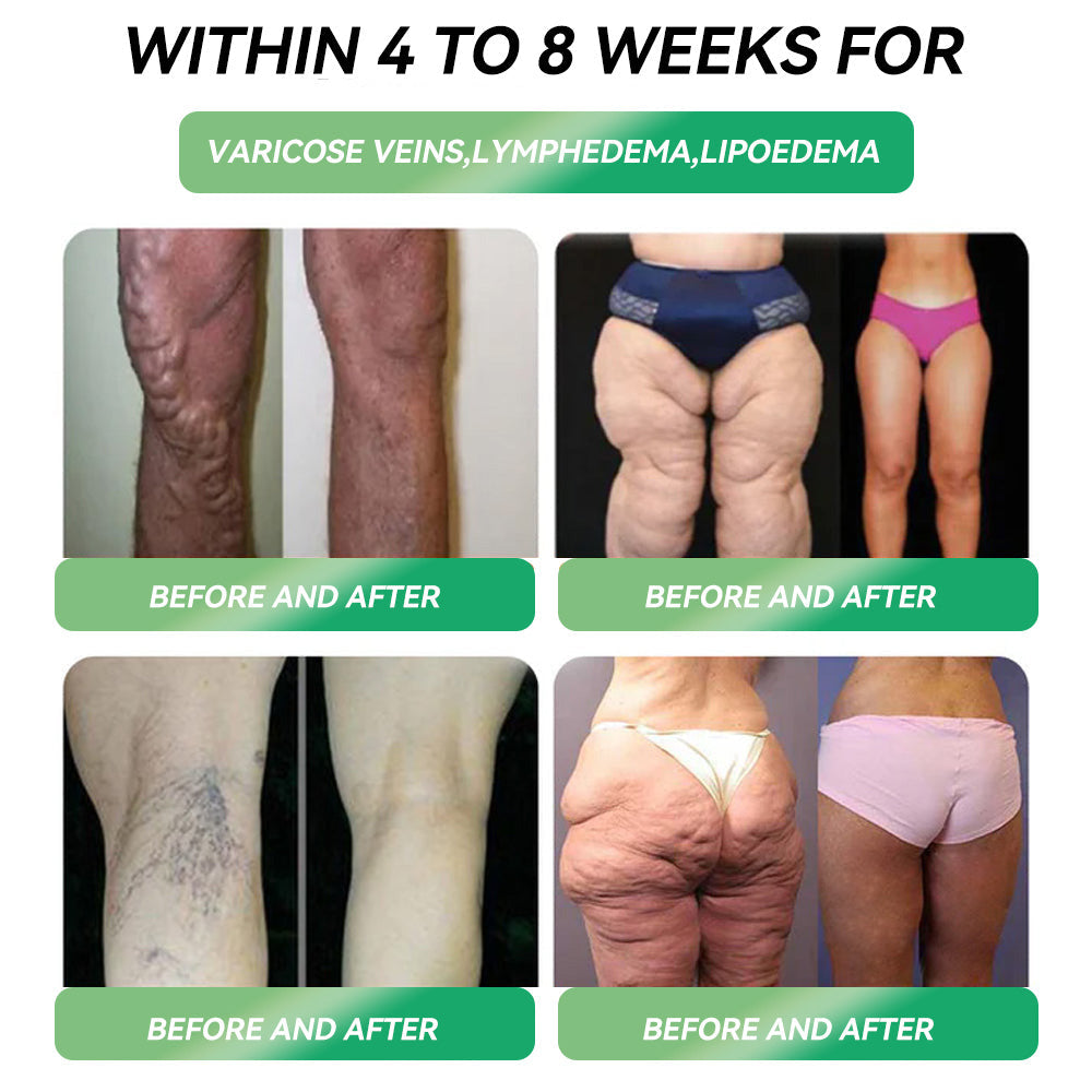Official Store ๐ฎ๐ช| PEAKAยฎ ๐ฟ๐ฟ GLP-1 Six-in-One Health Solution Oral Liquid (Just one dose a day โ visible results in just 7 days) โ
For: Obesity, Cardiovascular Health, Diabetes, Sleep Apnea, Joint Issues, and more.